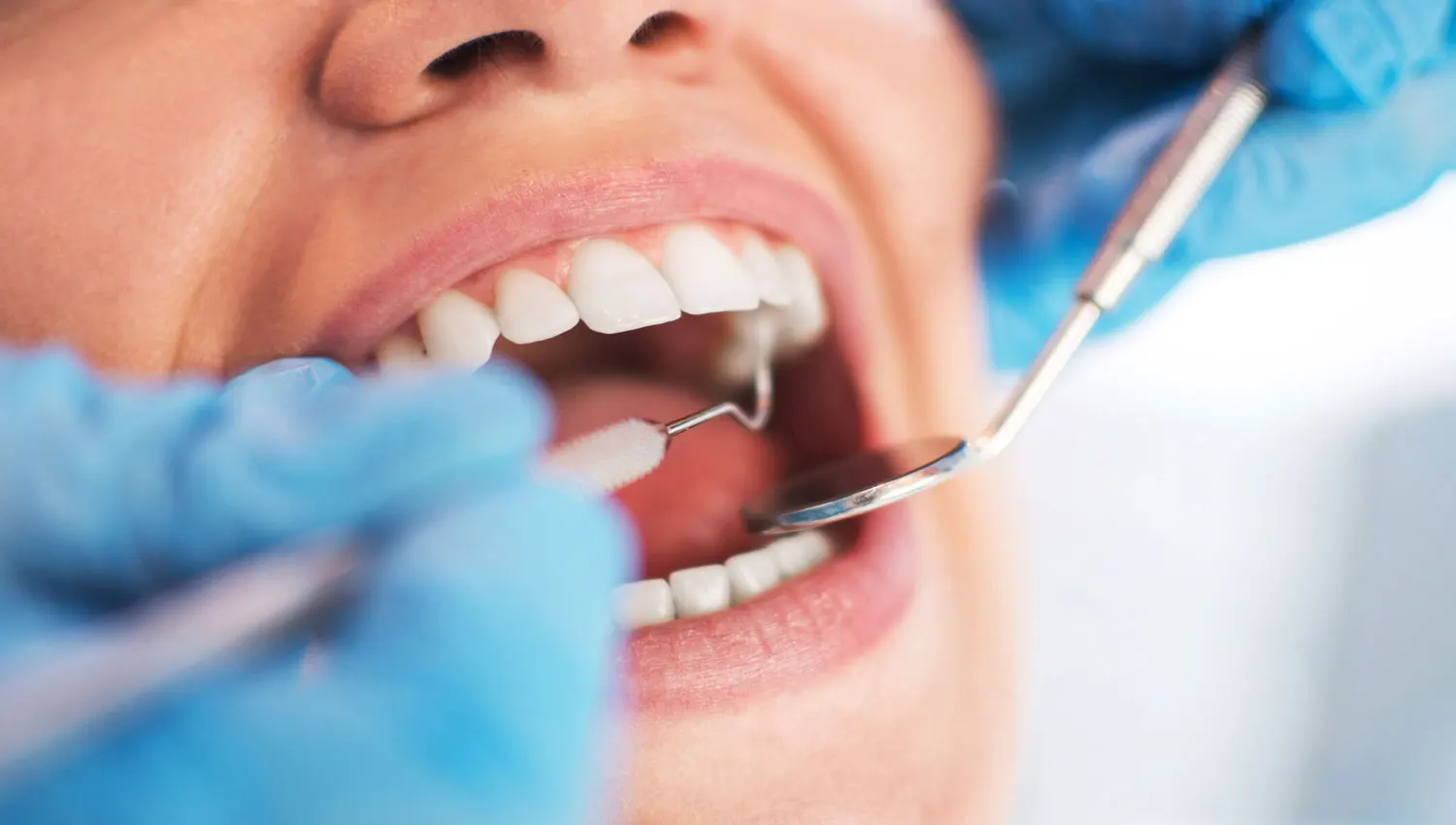چرا باید هر شش ماه یکبار به دندانپزشک مراجعه کنیم؟