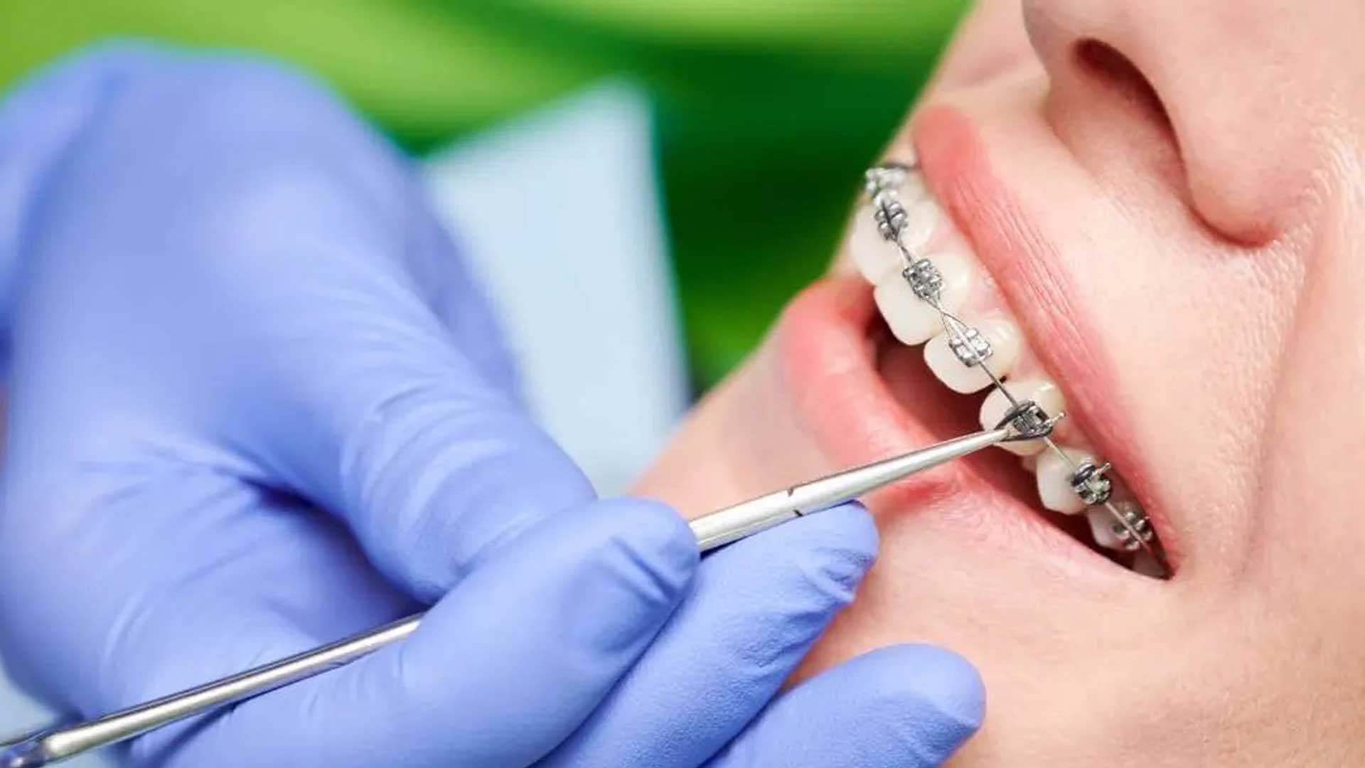بهترین روش های زیبایی دندان