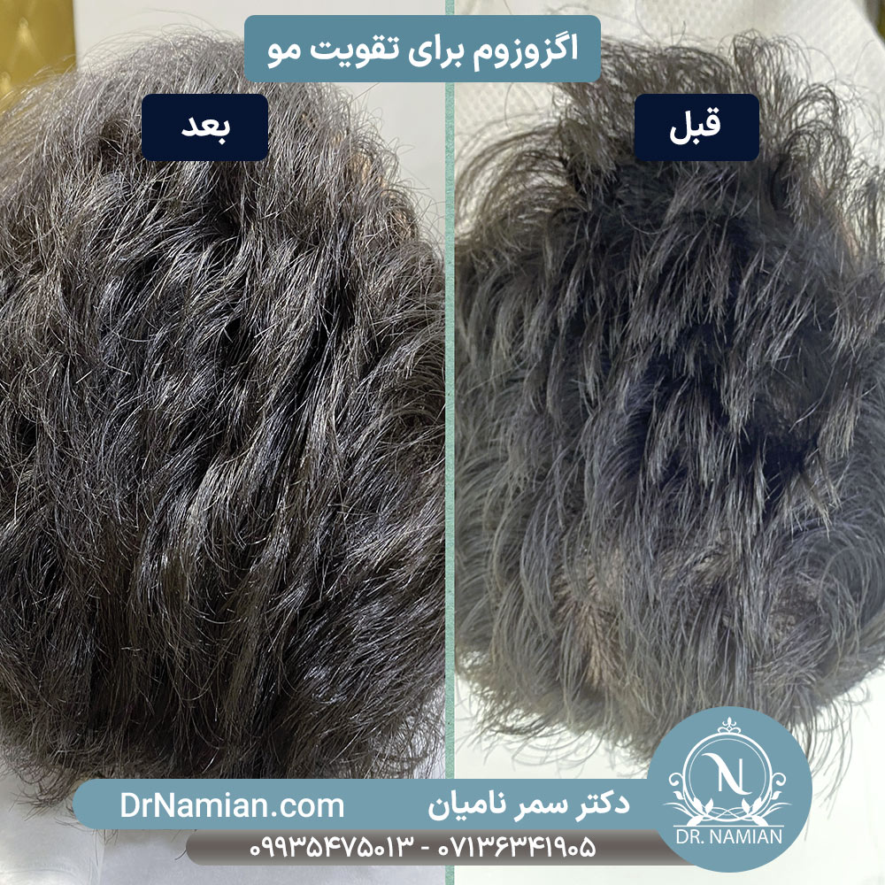 اگزوزوم چیست و چگونه عمل می‌کند؟