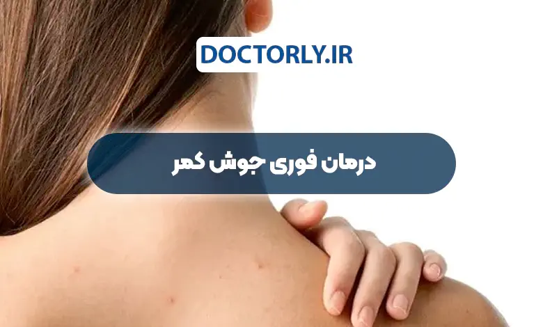 7 راهکار عملی رهایی از جوش‌های کمر