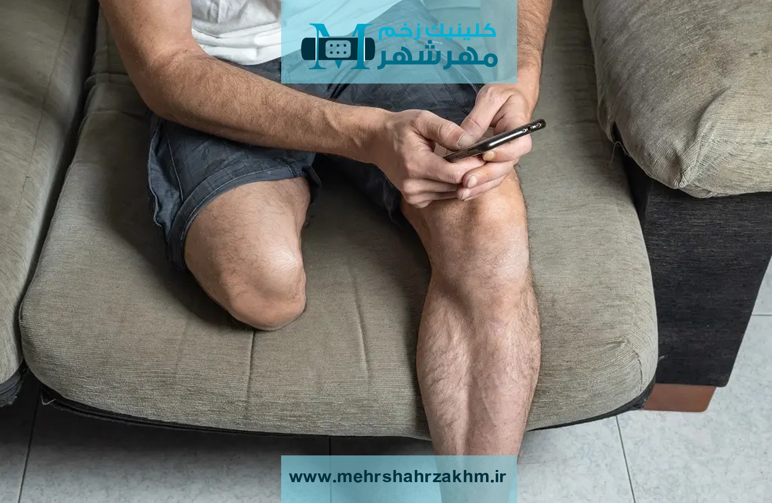 آیا ممکن است یک زخم ساده به قطع عضو منجر شود❓❗