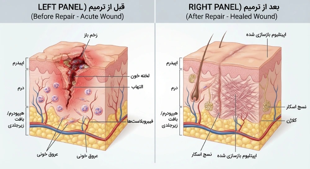 تغذیه و ترمیم زخم؛ بدن برای بهبود زخم به چه مواد مغذی نیاز دارد؟
